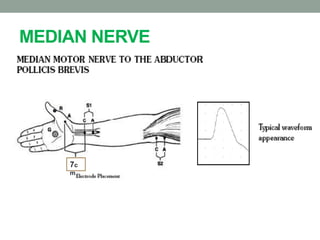 MEDIAN NERVE
7c
m
 