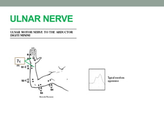 ULNAR NERVE
7c
m
 