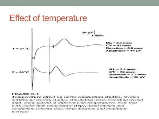 Effect of temperature
 