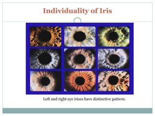 Individuality of Iris
Left and right eye irises have distinctive pattern.
 