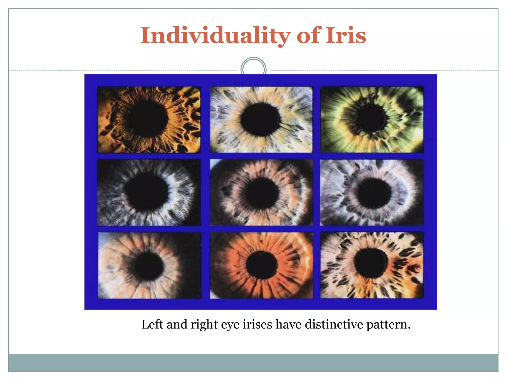 Individuality of Iris
Left and right eye irises have distinctive pattern.
 