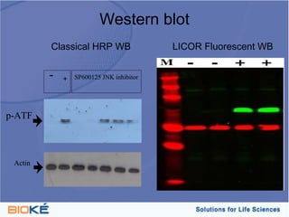 Western blot
         Classical HRP WB                 LICOR Fluorescent WB

         -   +   SP600125 JNK inhibitor




p-ATF



 Actin
 