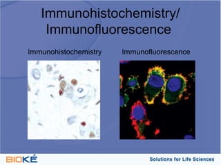 Immunohistochemistry/
    Immunofluorescence
Immunohistochemistry   Immunofluorescence
 