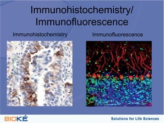 Immunohistochemistry/
       Immunofluorescence
Immunohistochemistry   Immunofluorescence
 