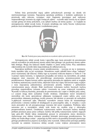 „Projekt współfinansowany ze środków Europejskiego Funduszu Społecznego”
43
Falista linia powierzchni trącej zębów policzkowych powstaje na skutek ich
nierównomiernego ścierania. Najczęściej spotykane problemy z końskim uzębieniem to
przetrwałe zęby mleczne, wystające, ostre fragmenty powstające pod wpływem
nieprawidłowego ścierania się ciągle rosnących zębów – wyrostki takie tworzą się na zębach
szczęki górnej od strony policzków, a na zębach Ŝuchwy od strony języka – ze względu na
anizognatyczny układ szczęk konia. Z czasem utrudniają one ruchy boczne wykonywane
podczas Ŝucia utrudniając pobieranie i rozdrabnianie paszy.
Rys. 16. Przekrój przez jamę ustną konia na wysokości zębów policzkowych [14]
Anizognatyczny układ szczęk konia i specyfika jego Ŝucia prowadzi do powstawania
ostrych wyrostków po policzkowej stronie zębów łuku górnego i po językowej stronie zębów
łuku dolnego. Mogą one kaleczyć tkanki miękkie w jamie ustnej konia. Przy zadziałaniu
odpowiedniej siły wyrostki takie mają tendencję do odłamywania się.
Największe problemy stwarza ostatni przedtrzonowiec – wyrzyna on się w momencie,
kiedy sąsiednie zęby są juŜ wyrośnięte. Stosunkowo wąski zębodół łatwo ulega "zatkaniu"
przez wymieniany ząb mleczny. Efekty tego są wyraźnie widoczne dopiero w wieku 6–7 lat
w postaci ropnia korzenia, w najlepszym przypadku zaś kończy się niewielkim, ale jednak
mogącym mieć znaczenie dla prawidłowego przeŜuwania, przemieszczeniem tego
przedtrzonowca. Ropnie korzeni zębów najczęściej prowadzą do zapalenia zatok ze względu
na budowę anatomiczną czaszki konia, objawami moŜe być ropny lub krwisto-ropny wypływ
z nosa (najczęściej jednostronny), powstawanie przetok, trudności z pobieraniem
i przeŜuwaniem paszy, obrzęki. Brak moŜliwości wykonania ruchów bocznych Ŝuchwą
powoduje nieprawidłowe ścieranie zębów i tworzenia się coraz większych wyrostków.
Wyrostki te kaleczą śluzówkę, prowadzą do powstawania ran i ropni w obrębie jamy ustnej,
a z czasem mogą takŜe uszkadzać twarde struktury. Zadziałanie nawet stosunkowo
niewielkiej siły moŜe spowodować odłamanie wystających części zębów, przy czym
powierzchnia załamania przebiega zwykle pionowo lub ukośnie co prowadzi do uszkodzeń
w głębszych warstwach zęba. Obecność wyrostków zmusza konia do nienaturalnego
przeŜuwania i zmienia rozkład sił działających na poszczególne zęby, w związku z czym
moŜe prowadzić do ich przyspieszonego ścierania lub nawet wypadania. Problemy takie
notowano juŜ u roczniaków, młody wiek konia nie zwalnia więc z obowiązku
przeprowadzania kontroli. Utrudnienie wykonywania ruchów bocznych Ŝuchwy skutkuje
próbami przeŜucia paszy przez cofnięcie Ŝuchwy lub próbą wykonywania ruchów Ŝujących
typu góra–dół. Skutki takiej nienaturalnej pozycji to przeciąŜenia stawu skroniowo-
Ŝuchwowego oraz słabsze ścieranie przedniej krawędzi pierwszego przedtrzonowca. Na
efekty nie trzeba długo czekać – pojawiają się bóle stawu a na przedniej krawędzi pierwszego
górnego przedtrzonowca pojawia się kolejny ostry wyrostek. Jednocześnie powstaje podobny
wyrostek na ostatnim trzonowcu dolnej szczęki i coraz większe przeciąŜenie stawu
 