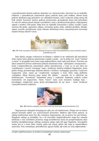 „Projekt współfinansowany ze środków Europejskiego Funduszu Społecznego”
45
z powodowaniem koniem podczas skręcania czy zatrzymywania, chowanie się za wędzidło,
trudności z prawidłowym ustawieniem głowy podczas pracy pod siodłem, obrona konia
podczas dotykania jego policzków czy zakładania kantara, Ŝucie wyłącznie jedną stroną lub
brak ruchów bocznych Ŝuchwy podczas przeŜuwania, gromadzenie paszy pod policzkami
(w celu ich ochrony przed ostrymi wyrostkami), Ŝucie z przekrzywioną głową, nieprzyjemny
zapach z nozdrzy i/lub pyska, ślady krwi na wędzidle, krwawienia z pyska, wysięki z jamy
nosowej lub pyska, zgrzytanie zębami, otwieranie pyska, kolki, zatkania przełyku, obrzęki,
ropnie, wycieki, powiększone węzły chłonne, deformacje kości, niesymetrycznie rozwinięte
mięśnie biorące udział w Ŝuciu.
Rys. 19. Ostry wyrostek na krawędzi ostatniego trzonowca moŜe ranić podniebienie a nawet uszkodzić tętnicę
podniebienną [14]
Inne objawy mogące wskazywać na kłopoty z zębami to np. nabieranie jak największej
ilości ziarna, które podczas przeŜuwania wypada z pyska – jest to próba tzw. Ŝucia "ziarnem
o ziarno" w przypadku koni, które mają nieprawidłowo starte zęby policzkowe. Powinno nas
takŜe zastanowić dziwne zachowanie podczas skarmiania siana – potrząsanie i otrzepywanie –
konie z nieprawidłowym ustawieniem zębów policzkowych, a więc co za tym idzie teŜ
z problemami z Ŝuciem "otrzepują" siano z drobnych, bardziej miękkich fragmentów, które
potem zlizują, pozostawiając elementy dłuŜsze i twardsze, wymagające gryzienia. Częściowe
rozgryzanie siana, ssanie go i wypluwanie występuje u koni, które mają problemy
z dziąsłami, błoną śluzową jamy ustnej lub zębami – pozwala im to odŜywiać się
drobniejszymi, "wyssanymi" elementami paszy a wypluwać fragmenty większe wobec
niemoŜności ich pogryzienia. TakŜe "mycie" siana czyli moczenie kaŜdego kęsa –
powodujące zmiękczenie paszy przed przystąpieniem do jej Ŝucia – moŜe świadczyć
o potrzebie kontroli uzębienia.
Rys. 20. Kamień osadzający się na kłach moŜe być przyczyną sporych problemów [14]
Najczęstszym zabiegiem korygującym zęby jest ich tarnikowanie. Polega ono na starciu
ostrych krawędzi zębów czy wytworzonych przerostów. Budowa zęba konia sprawia, Ŝe
zabieg tarnikowania moŜe być dla zwierzęcia nieprzyjemny, ale na pewno nie jest bolesny.
Regularne zabiegi są niezbędne, bo o ile niewielkie nieprawidłowości mogą być usunięte
tarnikiem o tyle wieloletnie przerosty mogą kwalifikować konia do przeprowadzenia duŜo
bardziej skomplikowanego zabiegu usunięcia całego zęba lub jego fragmentu. Szczególnie
waŜne jest to u koni, które straciły jeden lub więcej zębów lub mają je nieprawidłowo
ustawione. Przy normalnym, prawidłowym zgryzie kaŜdy ząb trafia na swój odpowiednik –
 