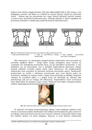 „Projekt współfinansowany ze środków Europejskiego Funduszu Społecznego”
46
podczas Ŝucia obydwa ulegają ścieraniu. Jeśli tego odpowiednika brak to stale rosnący, a nie
podlegający ścieraniu ząb będzie się wydłuŜał aŜ zacznie kaleczyć dziąsło po przeciwnej
stronie – efektem tego jest powstawanie ran i ropni, których bolesność znacznie utrudnia
a czasem wręcz uniemoŜliwia pobieranie paszy. Niekiedy dochodzi w takich wypadkach do
powaŜnych uszkodzeń w obrębie jamy ustnej lub nawet do deformacji kości.
Rys. 21. Przekrój przez jamę ustną konia na wysokości zębów policzkowych [14]
1. Zęby przed tarnikowaniem 2. Zęby po prawidłowym zabiegu
tarnikowania
3. Zęby "gładkie" – powierzchnia
trąca zębów zaokrąglona
Zbyt intensywne czy nieumiejętne przeprowadzenie tarnikowania moŜe prowadzić do
powstania "gładkich zębów" – brzegi zębów zostają zaokrąglone, pasza wysuwa się
z pomiędzy ich zaokrąglonej powierzchni trącej, nie jest prawidłowo przeŜuwana, a więc
trudniejsze jest jej przyswajanie. Jest to przykład nieprawidłowej interwencji, dlatego
kontrolę uzębienia i wszelkie zabiegi naleŜy zlecać fachowcowi. Źle przeprowadzane
tarnikowanie moŜe prowadzić do powstania nierównej powierzchni zgryzu. Tarnikowanie
przeprowadza się zwykle z załoŜonym rozwieraczem, przy czym obecnie poleca się
rozwieracze zakładane na siekacze, które z jednej strony pozwalają na dokładne obejrzenie
i dotarcie do wszystkich zębów, a z drugiej strony nie spowodują np. złamania zęba
policzkowego jeśli jest on wstający lub obluzowany. Nieprawidłowe uŜycie rozwieracza
moŜe doprowadzić do złamania szczęk u konia. Większość koni będzie wymagała podania
środków uspokajających przed przeprowadzeniem zabiegu.
Rys. 22. Łykawość takŜe moŜe powadzić do nadmiernego ścierania siekaczy [14]
W zaleŜności od rodzaju przeprowadzanego zabiegu i stanu końskiego uzębienia moŜe
okazać się konieczne podanie antybiotyków lub środków przeciwzapalnych, gdyŜ czasem tuŜ
po zabiegu, zanim koń nie przyzwyczai się do "nowych" ustawień w jego pysku objawy mogą
być bardziej nasilone niŜ przed zabiegiem. Dotyczyć to moŜe głównie tarnikowania
 