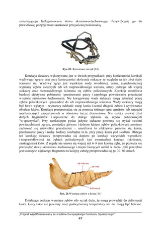 „Projekt współfinansowany ze środków Europejskiego Funduszu Społecznego”
47
zmieniającego funkcjonowanie stawu skroniowo-Ŝuchwowego. Przywrócenie go do
prawidłowej pozycji moŜe skutkować przejściową bolesnością.
Rys. 23. Rozwieracz szczęk [14]
Korekcja siekaczy wykonywana jest w dwóch przypadkach: przy konieczności korekcji
wadliwego zgryzu oraz przy konieczności skrócenia siekaczy ze względu na ich zbyt słabe
ścieranie się. Wadliwy zgryz jest wynikiem wady wrodzonej, urazu, asynchronicznej
wymiany zębów siecznych lub ich nieprawidłowego wzrostu, utraty jednego lub więcej
siekaczy oraz nieprawidłowego ścierania się zębów policzkowych. Korekcja umoŜliwia
bardziej efektywne pobieranie i przeŜuwanie paszy i zapobiega powstawaniu przeciąŜeń
w stawie skroniowo–Ŝuchwowym. Nie korygowane wady siekaczy mogą zaburzać pracę
zębów policzkowych i prowadzić do ich nieprawidłowego ścierania. Wady siekaczy mogą
być łatwo wykryte – wystarczy odsłonić wargi konia i ocenić długość zębów i wyrównanie
obydwu łuków. Korekcję przeprowadza się za pomocą róŜnego typu tarników lub narzędzi
mechanicznych zaopatrzonych w obrotowe tarcze diamentowe. Nie naleŜy usuwać zbyt
duŜych fragmentów i dopuszczać do stałego stykania się zębów policzkowych
"w spoczynku". Przy zamkniętym pysku jedynie siekacze powinny się stykać swoimi
powierzchniami zgryzu, pomiędzy górnym i dolnym łukiem zębów policzkowych powinny
zachować się niewielkie przestrzenie – umoŜliwia to efektywne pasienie się konia,
przeŜuwanie paszy i ruchy Ŝuchwy niezbędne m.in. przy pracy konia pod siodłem. Dlatego
teŜ korekcję siekaczy przeprowadza się dopiero po korekcji wszystkich wyrostków
i nieprawidłowości na zębach policzkowych i po ewentualnej korekcji (skrócenie,
zaokrąglenie) kłów. Z reguły nie usuwa się więcej niŜ 6–8 mm korony zęba, co pozwala nie
przeciąŜać stawu skroniowo–Ŝuchwowego i mięśni biorących udział w Ŝuciu. Jeśli potrzebne
jest usunięcie większego fragmentu to kolejny zabieg przeprowadza się po 30–60 dniach.
Rys. 24.Wymiana zębów u konia [14]
Działające podczas wymiany zębów siły są tak duŜe, Ŝe mogą prowadzić do deformacji
kości. Guzy takie nie powinny mieć podwyŜszonej temperatury ani nie mogą być bolesne.
 