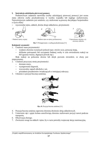 „Projekt współfinansowany ze środków Europejskiego Funduszu Społecznego”
37
I. Instrukcja udzielania pierwszej pomocy
Podstawowym zadaniem ratownika (osoby udzielającej pierwszej pomocy) jest ocena
stanu zdrowia osoby poszkodowanej w wyniku wypadku lub nagłego zachorowania.
NajwaŜniejszym zadaniem jest ustalenie, czy zachowane są procesy decydujące bezpośrednio
o Ŝyciu ofiary:
− wyczuwalne tętno, oddech, droŜne drogi oddechowe, przytomność.
1 Badanie tętnicy szyjnej 2 Badanie tętna na tętnicy promieniowej 3 Sprawdzanie słuchem, czy
ratowany oddycha.
Rys 7. Postępowanie z osobą poszkodowaną [11]
Kolejność czynności
1. Ustalenie stanu przytomności:
− wydanie choremu wyraźnych poleceń typu: otwórz oczy, poruszaj stopą,
− delikatne potrząsanie lub szczypanie badanej osoby w celu stwierdzenia reakcji na
ból (grymas twarzy, drgnięcie powiek itp.).
Brak reakcji na polecenia słowne lub dotyk pozwala stwierdzić, ze chory jest
nieprzytomny.
2. Ustalenie przyczyny utraty przytomności:
− doznane urazy,
− występowanie drgawek,
− wyczuwalny zapach alkoholu z ust,
− posiadanie przedmiotów świadczących o istniejącej cukrzycy.
3. UłoŜenie w pozycji bocznej ustalonej.
Rys. 8. Pozycja boczna ustalona [11]
4. Pozycja boczna ustalona zapewnia choremu droŜności dróg oddechowych.
5. Ustawienie rąk i zgięte kolana umoŜliwiają choremu zachowanie pozycji nawet podczas
transportu.
6. Obserwacja chorego.
7. Zwrócenie uwagi na oddech i tętno, by w razie potrzeby rozpocząć akcję reanimacyjną.
 