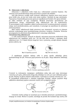 „Projekt współfinansowany ze środków Europejskiego Funduszu Społecznego”
38
II. Zaburzenia w oddychaniu
Zaburzenia w oddychaniu ściśle wiąŜą się z zaburzeniami czynności krąŜenia. Aby
uratować Ŝycie poszkodowanego naleŜy przywrócić czynność obu układów.
Jeśli jako pierwszy wystąpi zanik czynności oddechowej, krąŜenie moŜe trwać jeszcze
przez krótki czas, ale jest ono wtedy coraz mniej wydolne i dochodzi do jego zatrzymania.
Najczęstszą i bezpośrednią przyczyną zgonu po wypadkach jest bezdech. Do zgonu dochodzi
po kilku minutach od jego wystąpienia. Bezdech przewaŜnie spowodowany jest
uszkodzeniem mózgu, uszkodzeniem dróg oddechowych lub ich niedroŜnością.
W przewaŜającej części wypadków oddech moŜna przywrócić za pomocą prostych czynności,
ratując Ŝycie poszkodowanemu, pod warunkiem, Ŝe przystąpi się natychmiast do udzielenia
pierwszej pomocy.
Brak ruchów oddechowych klatki piersiowej oraz niemoŜność wyczucia na własnym
policzku wydychanego przez poszkodowanego powietrza, świadczą o bezdechu. Wówczas
przystępujemy do udroŜnienia dróg oddechowych i sztucznego oddychania.
UdroŜnienie dróg oddechowych
U osób nieprzytomnych, leŜących na plecach, najczęstszą przyczyną niedroŜności dróg
oddechowych jest zapadnięty język (rys. 10) lub ciało obce tkwiące i zatykające drogi
oddechowe (rys. 11). Ciałami obcymi mogą być: krew, wymiociny, szczątki ubrania, złamana
proteza zębowa, itp.
Rys. 9. Zapadnięty język [9] Rys. 10. Ciało obce [9]
Z zapadniętym językiem radzimy sobie w prosty sposób, odchylając głowę
poszkodowanego do tyłu. Wówczas język przesuwa się do góry i drogi oddechowe udraŜniają
się.
Rys. 11. Usuwanie zapadniętego języka [9]
Czynność tą wykonujemy następująco: podkładamy jedną rękę pod szyję ratowanego
i unosimy ją do góry, jednocześnie drugą rękę układając na czole, po czym odchylamy głowę
do tyłu. Staramy się głowę odchylić maksymalnie, wykonując tę czynność ostroŜnie (rys. 12).
W przypadkach podejrzanych o złamanie kręgosłupa szyjnego, zatkane językiem drogi
oddechowe udraŜniamy poprzez uniesienie Ŝuchwy lub wyciągnięcie języka.
Rys. 12. Unoszenie Ŝuchwy [9]
Uniesienie Ŝuchwy polega na wysunięciu jej w kierunku pionowym u poszkodowanego,
leŜącego na wznak. MoŜna to uzyskać, naciskając do przodu obu kciukami kąty Ŝuchwy lub
 