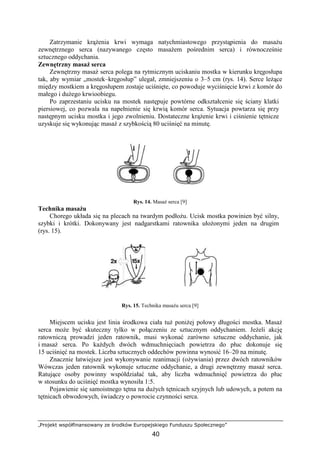 „Projekt współfinansowany ze środków Europejskiego Funduszu Społecznego”
40
Zatrzymanie krąŜenia krwi wymaga natychmiastowego przystąpienia do masaŜu
zewnętrznego serca (nazywanego często masaŜem pośrednim serca) i równocześnie
sztucznego oddychania.
Zewnętrzny masaŜ serca
Zewnętrzny masaŜ serca polega na rytmicznym uciskaniu mostka w kierunku kręgosłupa
tak, aby wymiar „mostek–kręgosłup” ulegał, zmniejszeniu o 3–5 cm (rys. 14). Serce leŜące
między mostkiem a kręgosłupem zostaje uciśnięte, co powoduje wyciśnięcie krwi z komór do
małego i duŜego krwioobiegu.
Po zaprzestaniu ucisku na mostek następuje powtórne odkształcenie się ściany klatki
piersiowej, co pozwala na napełnienie się krwią komór serca. Sytuacja powtarza się przy
następnym ucisku mostka i jego zwolnieniu. Dostateczne krąŜenie krwi i ciśnienie tętnicze
uzyskuje się wykonując masaŜ z szybkością 80 uciśnięć na minutę.
Rys. 14. MasaŜ serca [9]
Technika masaŜu
Chorego układa się na plecach na twardym podłoŜu. Ucisk mostka powinien być silny,
szybki i krótki. Dokonywany jest nadgarstkami ratownika ułoŜonymi jeden na drugim
(rys. 15).
Rys. 15. Technika masaŜu serca [9]
Miejscem ucisku jest linia środkowa ciała tuŜ poniŜej połowy długości mostka. MasaŜ
serca moŜe być skuteczny tylko w połączeniu ze sztucznym oddychaniem. JeŜeli akcję
ratowniczą prowadzi jeden ratownik, musi wykonać zarówno sztuczne oddychanie, jak
i masaŜ serca. Po kaŜdych dwóch wdmuchnięciach powietrza do płuc dokonuje się
15 uciśnięć na mostek. Liczba sztucznych oddechów powinna wynosić 16–20 na minutę.
Znacznie łatwiejsze jest wykonywanie reanimacji (oŜywiania) przez dwóch ratowników
Wówczas jeden ratownik wykonuje sztuczne oddychanie, a drugi zewnętrzny masaŜ serca.
Ratujące osoby powinny współdziałać tak, aby liczba wdmuchnięć powietrza do płuc
w stosunku do uciśnięć mostka wynosiła 1:5.
Pojawienie się samoistnego tętna na duŜych tętnicach szyjnych lub udowych, a potem na
tętnicach obwodowych, świadczy o powrocie czynności serca.
 