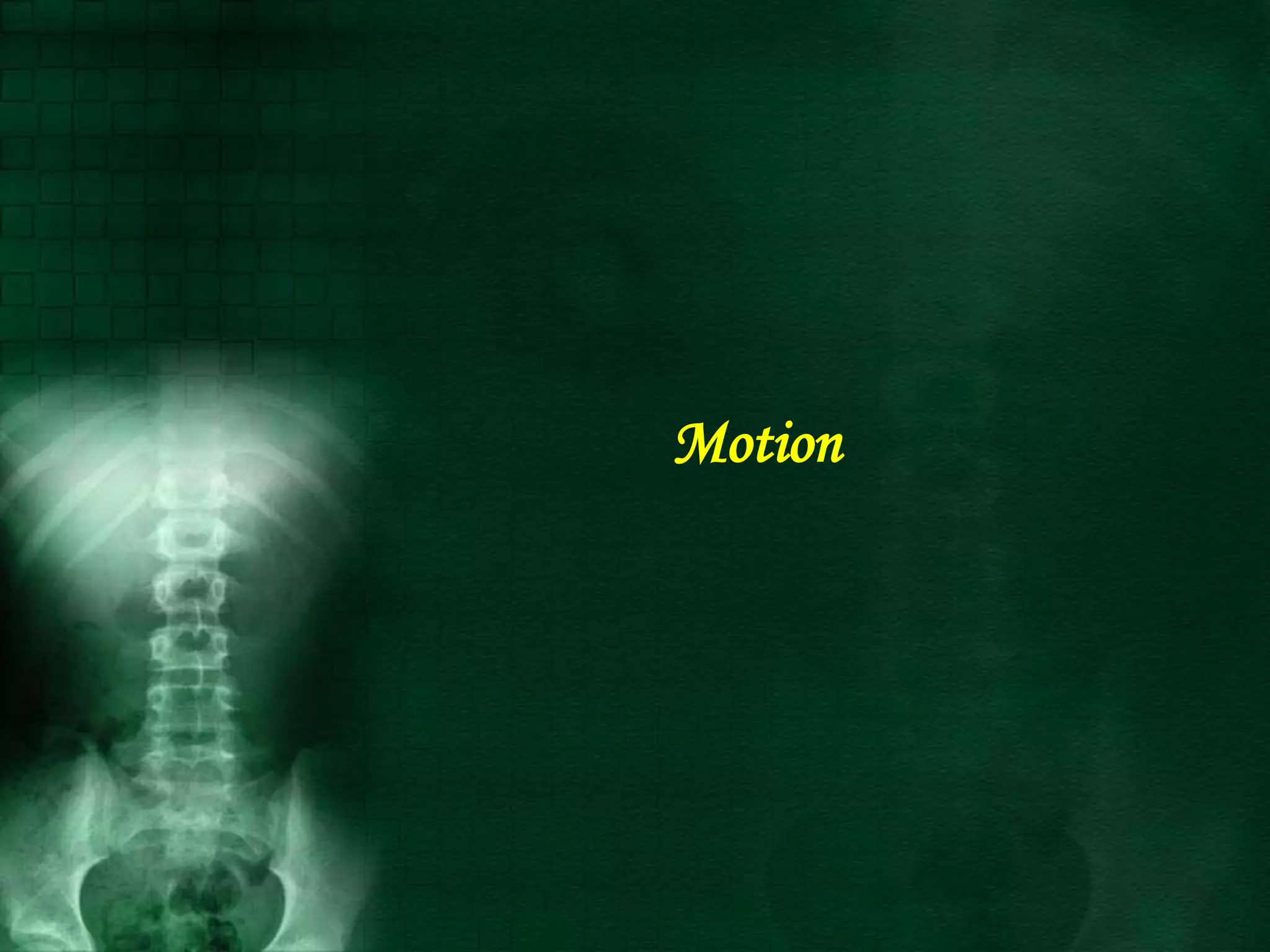 Motion
 