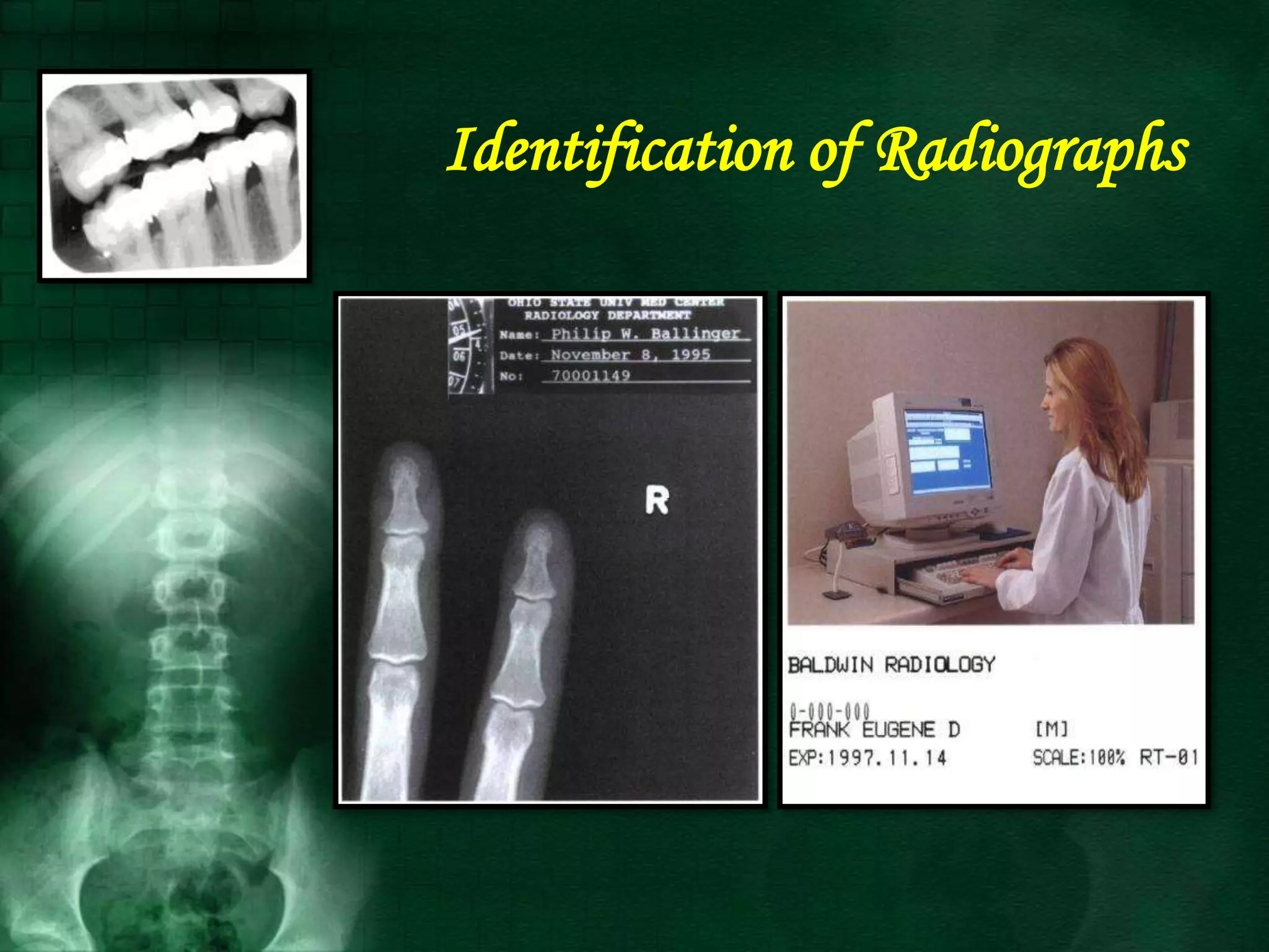 Identification of Radiographs
 