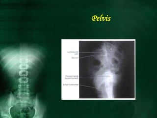 Pelvis
 