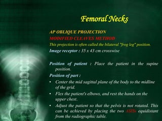 AP OBLIQUE PROJECTION
MODIFIED CLEAVES METHOD
This projection is often called the bilateral "frog leg" position.
Image receptor : 35 x 43 cm crosswise
Position of patient : Place the patient in the supine
position.
Position of part :
• Center the mid sagittal plane of the body to the midline
of the grid.
• Flex the patient's elbows, and rest the hands on the
upper chest.
• Adjust the patient so that the pelvis is not rotated. This
can be achieved by placing the two ASISs equidistant
from the radiographic table.
Femoral Necks
 