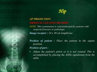 AP PROJECTION
ORIGINAL CLEAVES METHOD
NOTE: This examination is contraindicated for patients with
suspected fracture or pathologic.
Image receptor : 24 x 30 cm lengthwise
Position of patient : Place the patient in the supine
position.
Position of part :
• Adjust the patient's pelvis so it is not rotated. This is
accomplished by placing the ASISs equidistant from the
table.
Hip
 