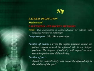 LATERAL PROJECTION
Mediolateral
LAUENSTEIN AND HICKEY METHODS
NOTE: This examination is contraindicated for patients with
suspected fracture or pathologic.
Image receptor : 24 x 30 cm crosswise
Position of patient : From the supine position, rotate the
patient slightly toward the affected side to an oblique
position. The degree of obliquity will depend on how
much the patient can abduct the leg.
Position of part :
• Adjust the patient's body, and center the affected hip to
the midline of the grid.
Hip
 