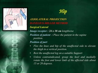 AXIOLATERAL PROJECTION
DANELIUS-MILLER METHOD
Surgical Lateral
Image receptor : 24 x 30 cm lengthwise
Position of patient : Place the patient in the supine
position.
Position of part
• Flex the knee and hip of the unaffected side to elevate
the thigh in a vertical position.
• Rest the unaffected leg on a suitable Support
• Unless contraindicated, grasp the heel and medially
rotate the foot and lower limb of the affected side about
15 or 20 degrees.
Hip
 