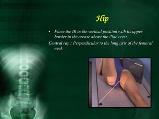 Hip
• Place the IR in the vertical position with its upper
border in the crease above the iliac crest.
Central ray : Perpendicular to the long axis of the femoral
neck.
 