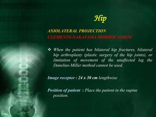 AXIOLATERAL PROJECTION
CLEMENTS-NAKAYAMA MODIFICATIONl
 When the patient has bilateral hip fractures, bilateral
hip arthroplasty (plastic surgery of the hip joints), or
limitation of movement of the unaffected leg the
Danelius-Miller method cannot be used.
Image receptor : 24 x 30 cm lengthwise
Position of patient : Place the patient in the supine
position.
Hip
 