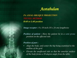 PA AXIAL OBLIQUE PROJECTION
TEUFEL METHOD
RAO or LAO position
Image receptor : 8 x 10 inch (18 x 24 cm) lengthwise
Position of patient : Have the patient lie in a semi prone
position on the affected side.
Position of part :
• Align the body, and center the hip being examined to the
midline of the grid.
• Elevate the unaffected side so that the anterior surface
of the body forms a 38-degree angle from the table.
Acetabulum
 