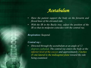 • Have the patient support the body on the forearm and
flexed knee of the elevated side.
• With the IR in the Bucky tray, adjust the position of the
IR so that its midpoint coincides with the central ray.
Respiration: Suspend.
Central ray :
• Directed through the acetabulum at an angle of 12
degrees cephalad. The central ray enters the body at the
inferior level of the coccyx and approximately 2 inches
(5 cm) lateral to the midsagittal plane toward the side
being examined.
Acetabulum
 