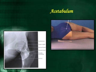 Acetabulum
 