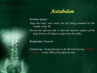 Position of part :
Align the body, and center the hip being examined to the
middle of the IR.
Elevate the affected side so that the anterior surface of the
body forms a 45 degree angle from the table .
Respiration: Suspend.
Central ray : Perpendicular to the IR and entering 2 inches
inferior to the ASIS of the affected side.
Acetabulum
 