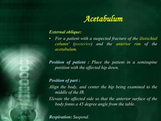 External oblique:
• For a patient with a suspected fracture of the ilioischial
column' (posterior) and the anterior rim of the
acetabulum.
Position of patient : Place the patient in a semisupine
position with the affected hip down.
Position of part :
Align the body, and center the hip being examined to the
middle of the IR.
Elevate the affected side so that the anterior surface of the
body fonns a 45 degree angle from the table.
Respiration: Suspend.
Acetabulum
 