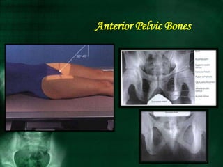 Anterior Pelvic Bones
 
