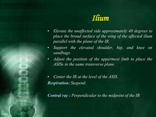 • Elevate the unaffected side approximately 40 degrees to
place the broad surface of the wing of the affected ilium
parallel with the plane of the IR.
• Support the elevated shoulder, hip, and knee on
sandbags.
• Adjust the position of the uppermost limb to place the
ASISs in the same transverse plane.
• Center the IR at the level of the ASIS.
Respiration: Suspend.
Central ray : Perpendicular to the midpoint of the IR
Ilium
 