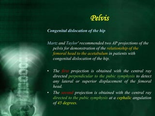 Congenital dislocation of the hip
Martz and Taylor' recommended two AP projections of the
pelvis for demonstration of the relationship of the
femoral head to the acetabulum in patients with
congenital dislocation of the hip.
• The first projection is obtained with the central ray
directed perpendicular to the pubic symphysis to detect
any lateral or superior displacement of the femoral
head.
• The second projection is obtained with the central ray
directed to the pubic symphysis at a cephalic angulation
of 45 degrees.
Pelvis
 