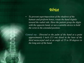 • To prevent superimposition of the shadows of the
hamate and pisiform bones, rotate the hand slightly
toward the radial side. Have the patient grasp the digits
with the opposite hand, or use a suitable device to hold
the wrist in the extended position.
Central ray : Directed to the palm of the hand at a point
approximately I inch (2.5 cm) distal to the base of the
third metacarpal and at an angle of 25 to 30 degrees to
the long axis of the hand.
Wrist
 