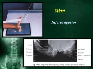 Wrist
Inferosuperior
 
