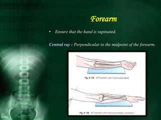 • Ensure that the hand is supinated.
Central ray : Perpendicular to the midpoint of the forearm.
Forearm
 