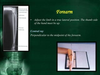 • Adjust the limb in a true lateral position. The thumb side
of the hand must be up.
Central ray
Perpendicular to the midpoint of the forearm.
Forearm
 