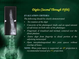 EVALUATION CRITERIA
The following should be clearly demonstrated:
• No rotation of the digit
• Concavity of the phalangeal shafts and an equal amount
of soft tissue on both sides of the phalanges
• Fingernail, if visualized and normal, centered over the
distal phalanx
• Entire digit from fingertip to distal portion of the
adjoining metacarpal
• Open interphalangealand Mcr joint spaces without
overlap of bones.
NOTE: When joint injury is suspected, an AP projection is
recommended instead of a PA projection.
Digits (Second Through Fifth)
 