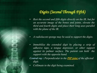 • Rest the second and fifth digits directly on the IR, but for
an accurate image of the bones and joints, elevate the
third and fourth digits and place their long axes parallel
with the plane of the IR.
• A radiolucent sponge may be used to support the digits.
• Immobilize the extended digit by placing a strip of
adhesive tape, a tongue depressor, or other support
against its palmar surface. The patient can hold the
support with the opposite hand.
Central ray : Perpendicular to the PIP joint of the affected
digit.
• Collimate to the digit being examined.
Digits (Second Through Fifth)
 