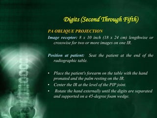 Digits (Second Through Fifth)
PA OBLIQUE PROJECTION
Image receptor: 8 x 10 inch (18 x 24 cm) lengthwise or
crosswise for two or more images on one IR.
Position at patient: Seat the patient at the end of the
radiographic table.
• Place the patient's forearm on the table with the hand
pronated and the palm resting on the IR.
• Center the IR at the level of the PIP joint.
• Rotate the hand externally until the digits are separated
and supported on a 45-degree foam wedge.
 