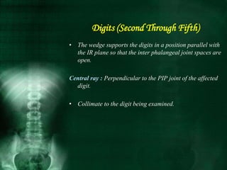 • The wedge supports the digits in a position parallel with
the IR plane so that the inter phalangeal joint spaces are
open.
Central ray : Perpendicular to the PIP joint of the affected
digit.
• Collimate to the digit being examined.
Digits (Second Through Fifth)
 