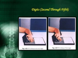 Digits (Second Through Fifth)
 