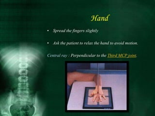 Hand
• Spread the fingers slightly
• Ask the patient to relax the hand to avoid motion.
Central ray : Perpendicular to the Third MCP joint.
 