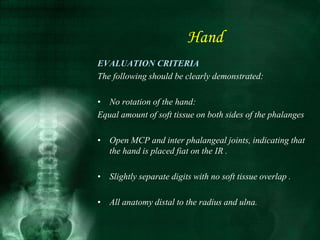 EVALUATION CRITERIA
The following should be clearly demonstrated:
• No rotation of the hand:
Equal amount of soft tissue on both sides of the phalanges
• Open MCP and inter phalangeal joints, indicating that
the hand is placed fiat on the IR .
• Slightly separate digits with no soft tissue overlap .
• All anatomy distal to the radius and ulna.
Hand
 