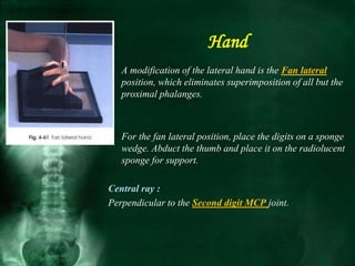 Hand
• A modification of the lateral hand is the Fan lateral
position, which eliminates superimposition of all but the
proximal phalanges.
• For the fan lateral position, place the digits on a sponge
wedge. Abduct the thumb and place it on the radiolucent
sponge for support.
Central ray :
Perpendicular to the Second digit MCP joint.
 