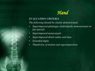 EVALUATION CRITERIA
The following should be clearly demonstrated:
• Superimposed phalanges (individually demonstrated on
fan lateral)
• Superimposed metacarpals
• Superimposed distal radius and ulna
• Extended digits
• Thumb free of motion and superimposition
Hand
 