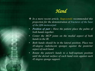  In a more recent article, Stapczynski recommended this
projection for the demonstration of fractures of the base
of the fifth metacarpal.
• Position of part : Have the patient place the palms of
both hands together.
• Center the MCP joints on the medial aspect of both
hands to the IR.
• Both hands should be in the lateral position. Place two
45-degree radiolucent sponges against the posterior
aspect of each hand.
• Rotate the patient's hands to a half-supinate position
until the dorsal surface of each hand rests against each
45 degree sponge support.
Hand
 
