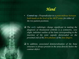 • Central ray : Perpendicular to a point midway between
both hands at the level of the MCP joints for either of
the two patient positions.
 The early radiologic change significant in making the
diagnosis of rheumatoid arthritis is a symmetric, very
slight, indistinct outline of the bone corresponding to the
insertion of the joint capsule dorsoradial on the
proximal end of the first phalanx of the four fingers.
 In addition, associated demineralization of the bone
structure is always present in the area directly below the
contour defect.
Hand
 