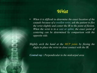 • When it is difficult to determine the exact location of the
carpals because of a swollen wrist, ask the patient to flex
the wrist slightly and center the IR to the point of flexion.
When the wrist is in a cast or splint, the exact point of
centering can be determined by comparison with the
opposite side.
Slightly arch the hand at the MCP joints by flexing the
digits to place the wrist in close contact with the IR.
Central ray : Perpendicular to the midcarpal area
Wrist
 