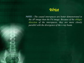 NOTE : The carpal interspaces are better demonstrated in
the AP image than the PA image. Because of the oblique
direction of the interspaces, they are more closely
parallel with the divergence of the x-ray beam.
Wrist
 