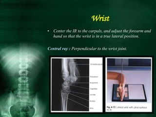 • Center the IR to the carpals, and adjust the forearm and
hand so that the wrist is in a true lateral position.
Central ray : Perpendicular to the wrist joint.
Wrist
 